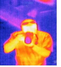 Infrared Radiation Therapy Infrared Radiation Therapy